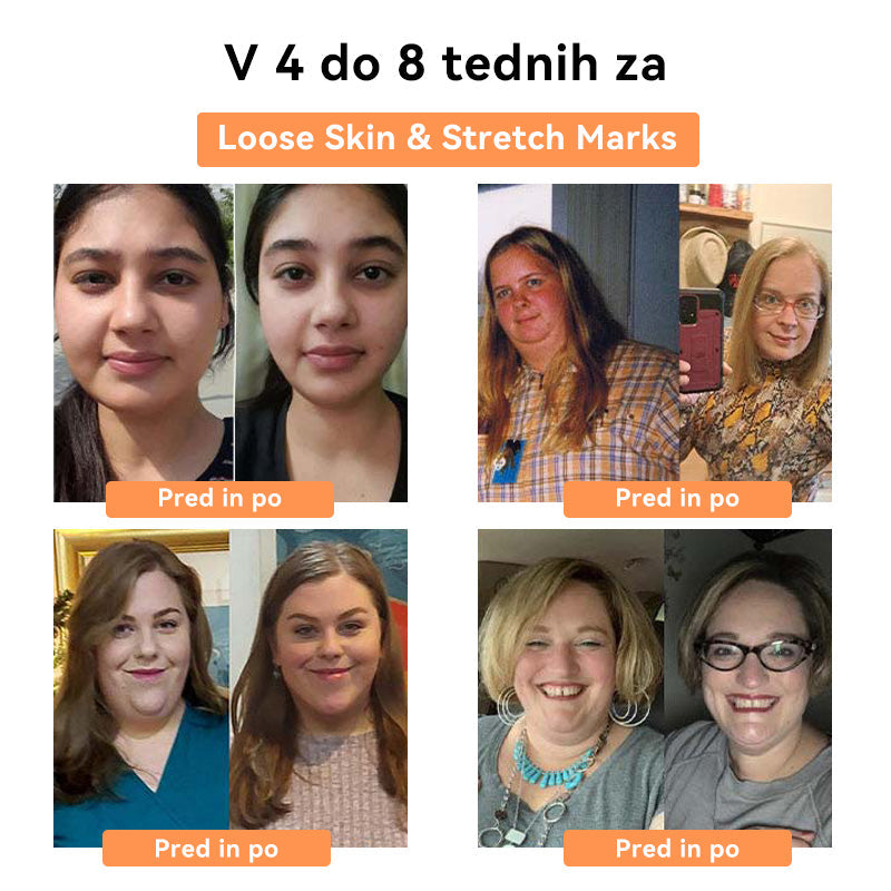 𝐅𝐑𝐎𝐏𝐔𝐍™ 👩‍⚕️„Pogoji za hujšanje z apitoksinom za limfno drenažo“ (za vse limfne težave in debelost)