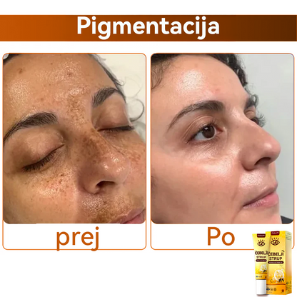 Oyikey™💥💥Čebelji strup Krema za oči Wake Up Priporoča dermatolog.