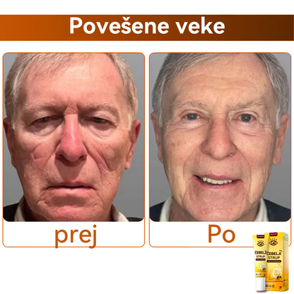 Oyikey™💥💥Čebelji strup Krema za oči Wake Up Priporoča dermatolog.