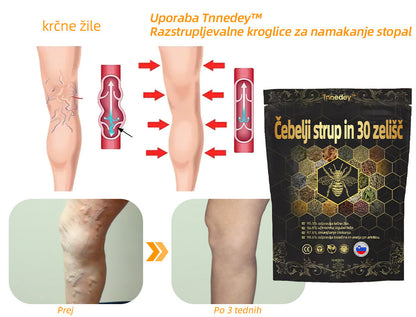 💎📦Zadnji dan, da bi dobili 70% OFF: Tnnedey® 𝑽č𝒆𝒍í 𝒋𝒆𝒅 𝒂 30 𝒃𝒚𝒍𝒊𝒏𝒏é 𝒅𝒆𝒕𝒐𝒙𝒊𝒌𝒂č𝒏é 𝒈𝒖ľôč𝒌𝒚 𝒏𝒂 𝒌ú𝒑𝒆ľ 𝒏ô𝒉 𝒑𝒓𝒆 𝒕𝒗𝒂𝒓𝒐𝒗𝒂𝒏𝒊𝒆 𝒕𝒆𝒍𝒂- Priporoča Ameriška limfna akademija (ALA)🧀