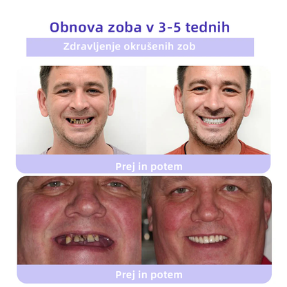 ✅Uradna trgovina: 𝐎𝐲𝐢𝐤𝐞𝐲™ Mineralni prah za obnovo zob 🦷 (Priporočeno s strani SDA) (🎁 Ekskluzivna promocija - Ne zamudite)