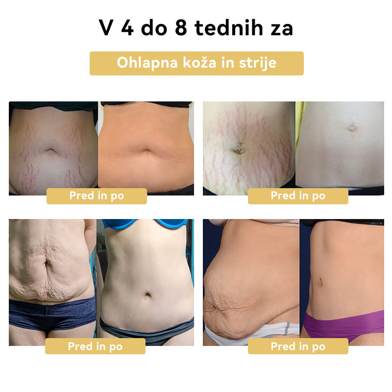 🥜𝑭𝑹𝑶𝑷𝑼𝑵™𝑲𝒓𝒆𝒎𝒂 𝒛𝒂 𝒉𝒖𝒋š𝒂𝒏𝒋𝒆 𝒔 č𝒆𝒃𝒆𝒍𝒋𝒊𝒎 𝒔𝒕𝒓𝒖𝒑𝒐𝒎⭐(𝒁𝒂 𝒗𝒔𝒆 𝒍𝒊𝒎𝒇𝒏𝒆 𝒕𝒆ž𝒂𝒗𝒆 𝒊𝒏 𝒅𝒆𝒃𝒆𝒍𝒐𝒔𝒕)