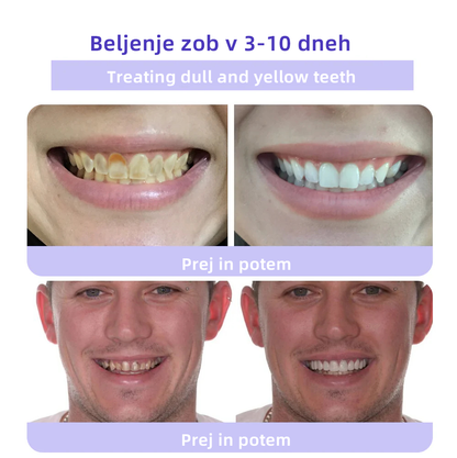 ✅Uradna trgovina: 𝐎𝐲𝐢𝐤𝐞𝐲™ Mineralni prah za obnovo zob 🦷 (Priporočeno s strani SDA) (🎁 Ekskluzivna promocija - Ne zamudite)